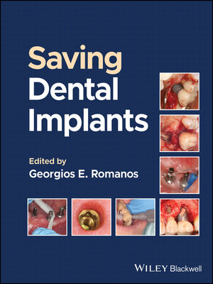 cover image of Saving Dental Implants
